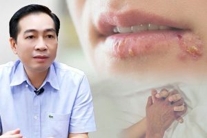 HIV là một loại bệnh có thể lây qua đường tình dục thường thấy.