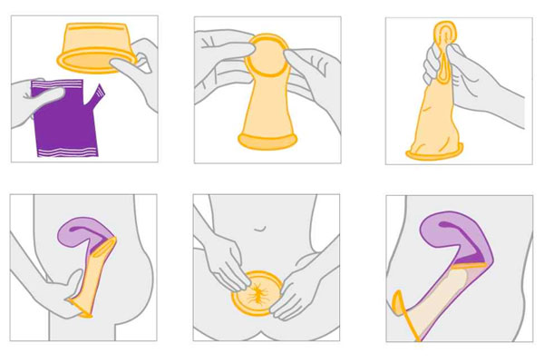Các bước sử dụng bao cao su dùng cho nữ Các bước sử dụng bao cao su dùng cho nữ