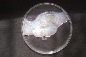 Tinh trùng bình thường sẽ có màu trắng đục hoặc xám