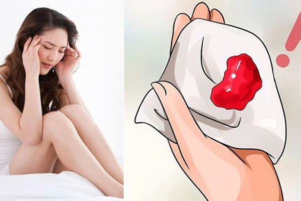 Chu kỳ kinh nguyệt trùng với thời điểm quan hệ có thể làm chảy máu Chu kỳ kinh nguyệt trùng với thời điểm quan hệ có thể làm chảy máu