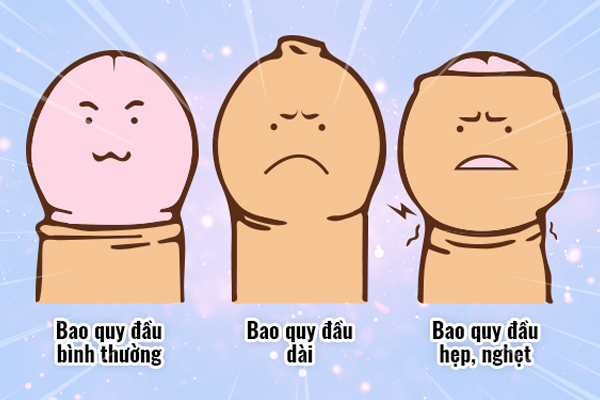 Bệnh lý thường gặp ở bao quy đầu gây khó khăn trong sinh hoạt hàng này cho nam giới Bệnh lý thường gặp ở bao quy đầu gây khó khăn trong sinh hoạt hàng này cho nam giới